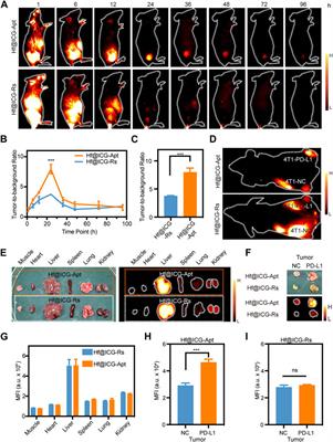 PD-L1 aptamer-functionalized degradable hafnium oxide nanoparticles for near infrared-II diagnostic imaging and radiosensitization